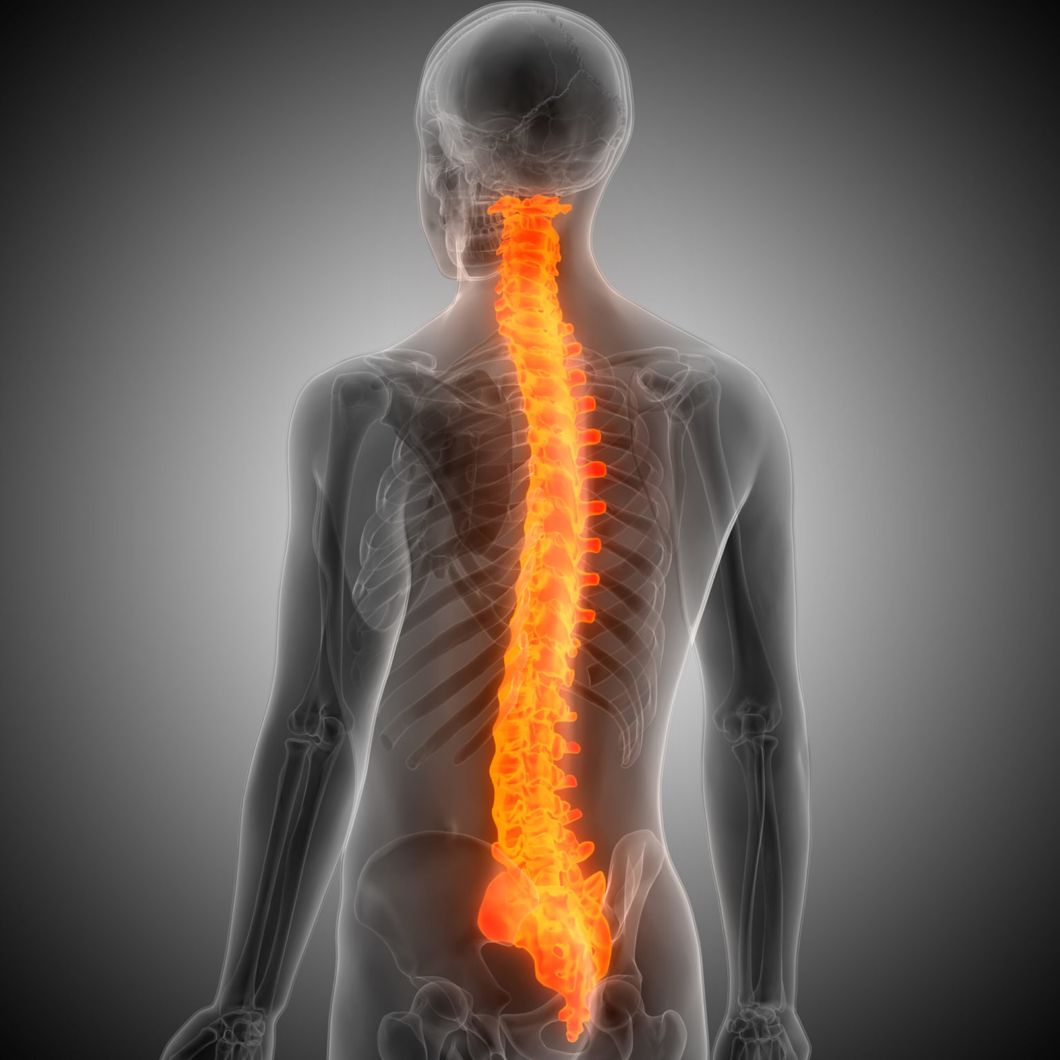 Overview and Legal Basis of Spinal Cord Injury Lawsuits - Real Legal News